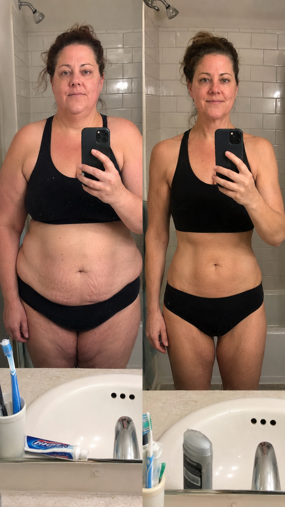 Sandra before and after
